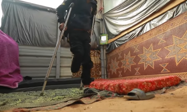 GAZA. Ogni giorno 10 bambini perdono una o entrambe le gambe
