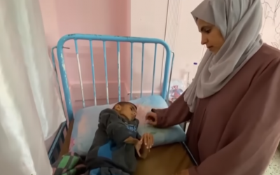 Gaza nel futuro: amputazioni e disabilità permanenti